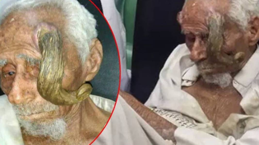 O yaştan boynuzları çıkmıştı! Boynuzlu dededen kahreden haber: Kimse gerçek olduğuna inanmamıştı ama... 1